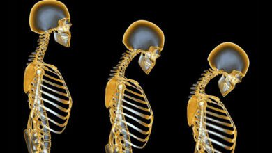 Photo of خواتین میں عقل کے زوال اور ہڈیوں میں فریکچر میں کیا تعلق ہے؟